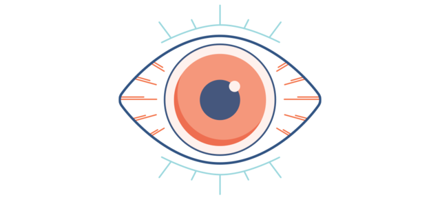 Illustration of a dry, red and painful eye
