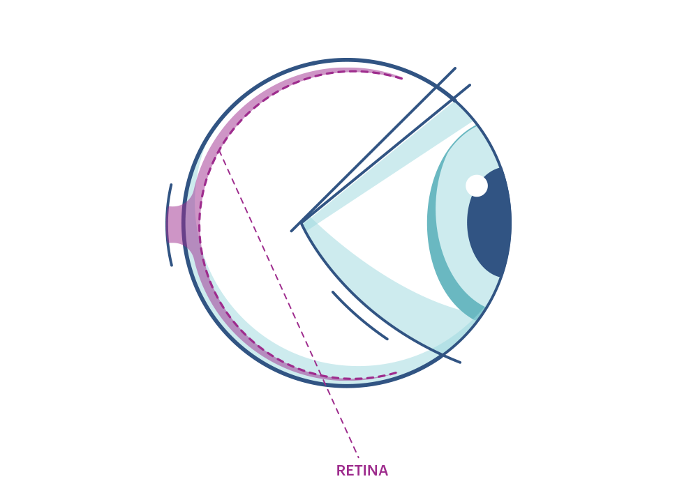Illustration of any eye highlighting the Retina